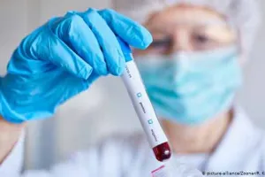 वेनेंजुएला ने कोरोना के वैक्सीन की टेस्टिंग में रूस को सहयोग