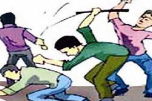 दबंगों ने एक गरीब परिवार के साथ मारपीट कर पिता-पुत्र को आग, बचाने गई महिला भी झुलसी