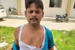 चिरैया में सरपंच पर जानलेवा हमला, पूर्व मुखिया पति पर लगाया हमले का आरोप