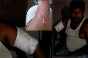 मोतिहारी में अपराधियों ने जमीन कारोबारी को चाकू मार किया घायल, लूटे 2 लाख 75 हजार रूपए 