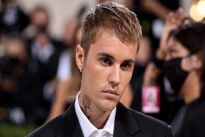 खतरनाक वायरस की वजह से जस्टिन बीबर का चेहरा हुआ पैरालिसिस